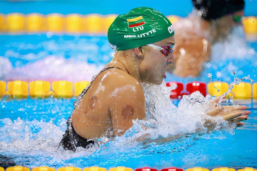 Sportski cupping: prirodna rehabilitacija — prirodni tretman, prirodna terapija, holistički oporavak, alternativna medicina