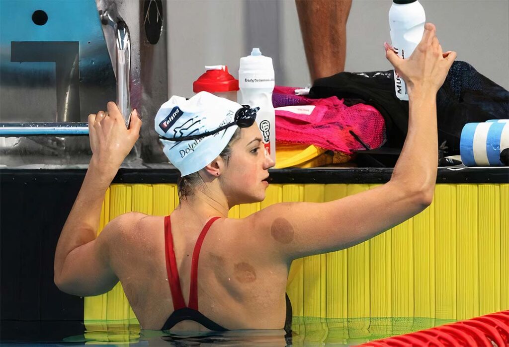 Sportski cupping: regeneracija mišića — mišićni oporavak, obnova snage, mišićna relaksacija, brži oporavak
