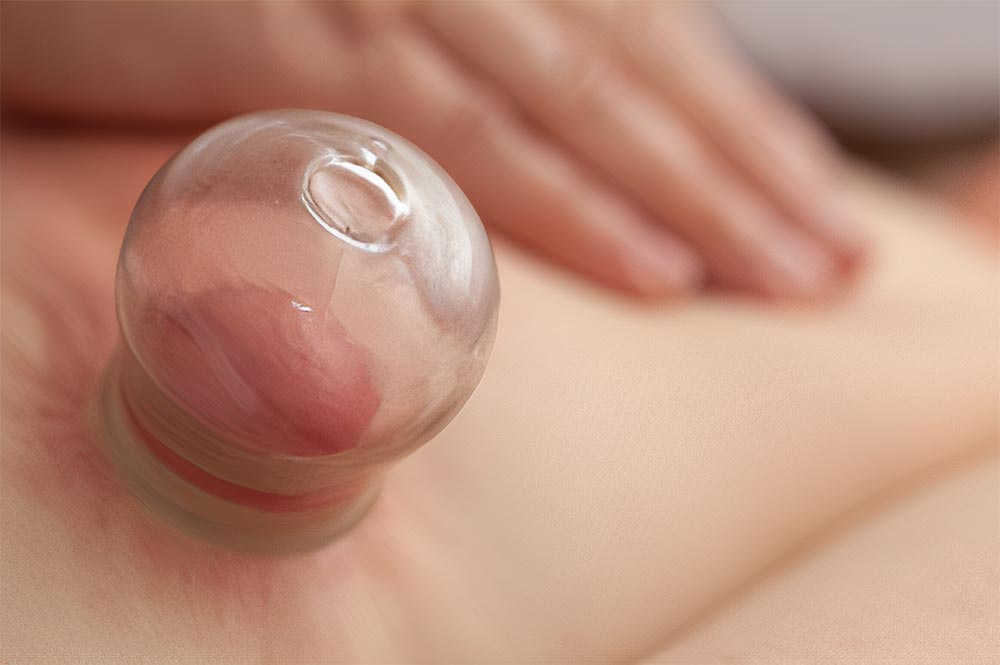 Suhi cupping (vatrom): detoksikacija organizma — čišćenje tijela, uklanjanje toksina, prirodna detoksikacija, obnova energije